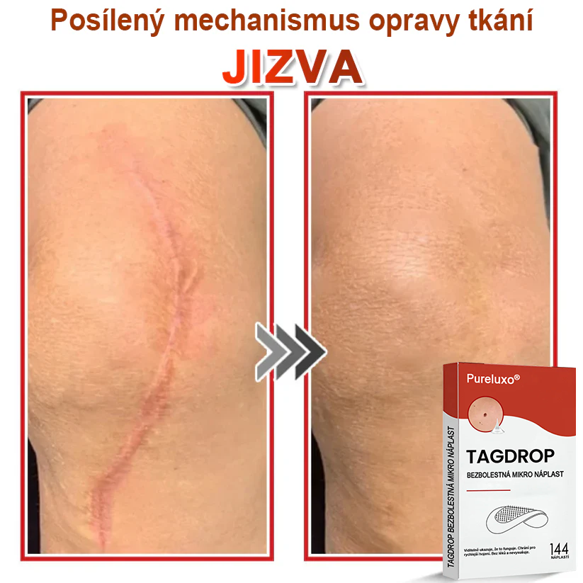 Pureluxo® Mikrovpichová botanická náplast na odstranění kožních výrůstků 🇨🇿 Vyrobeno v Česká republika