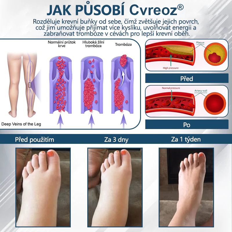 Cvreoz® Černý kmín Edema Detoxikační bylinný krém✨