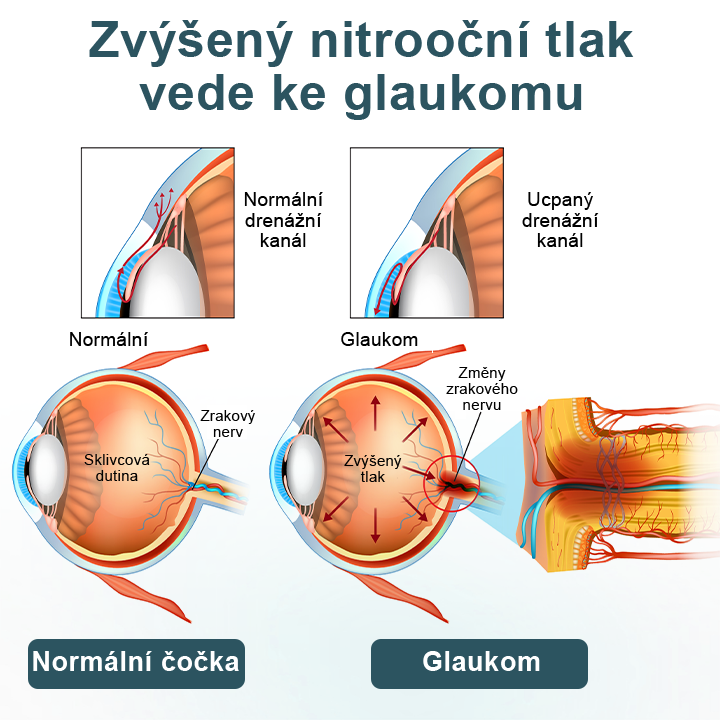 Oční kapky Timilk® optifusion nano sérum – nanotechnologie obnovuje jasný zrak, bez brýlí, bez chirurgického zákroku