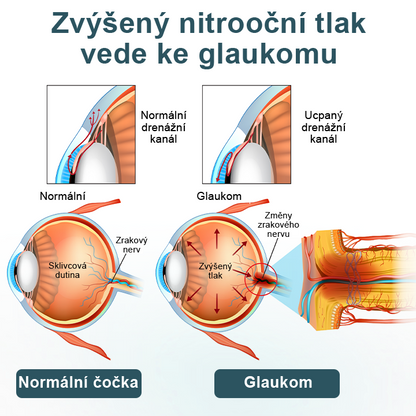 Oční kapky Timilk® optifusion nano sérum – nanotechnologie obnovuje jasný zrak, bez brýlí, bez chirurgického zákroku