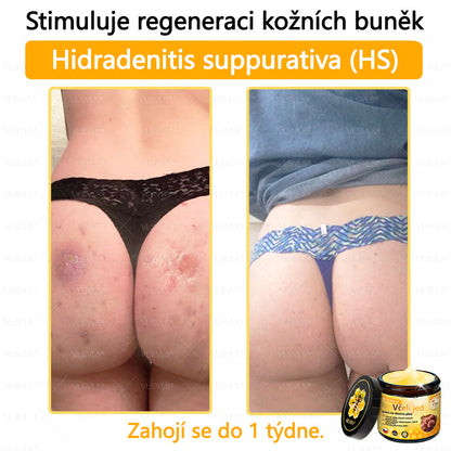 ✅VLSVLS™ Obnovující krém se včelím jedem🐝🐝