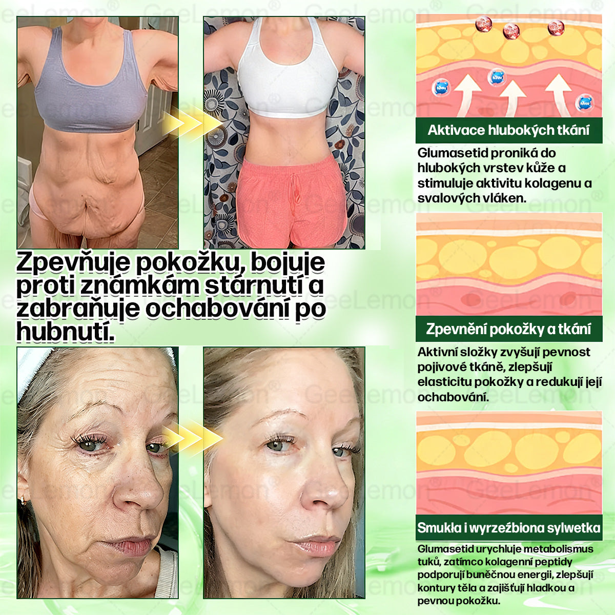 🔥Doporučeno Fakultní nemocnicí Motol · 👩‍⚕️ Oficiální prodejna BENU | 🎁 𝐆𝐞𝑒𝑙𝑒𝐦𝐨𝐧® Glum𝐚𝐬𝐞tide 8 v 1 – Zeštíhlující nano mikrojihlový náplast 🇨🇿 Jen 1× denně ✅ Viditelné změny za 7 dní – na obezitu, kardiovaskulární zdraví, diabetes a kloubní problémy🎁🎁🎁🎁