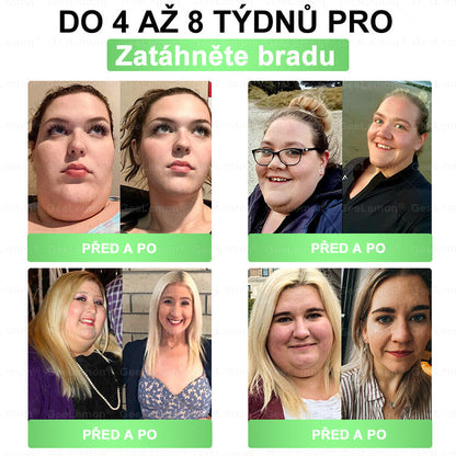 🔥Doporučeno Fakultní nemocnicí Motol · 👩‍⚕️ Oficiální prodejna BENU | 🎁 𝐆𝐞𝑒𝑙𝑒𝐦𝐨𝐧® Glum𝐚𝐬𝐞tide 8 v 1 – Zeštíhlující nano mikrojihlový náplast 🇨🇿 Jen 1× denně ✅ Viditelné změny za 7 dní – na obezitu, kardiovaskulární zdraví, diabetes a kloubní problémy🎁🎁🎁🎁