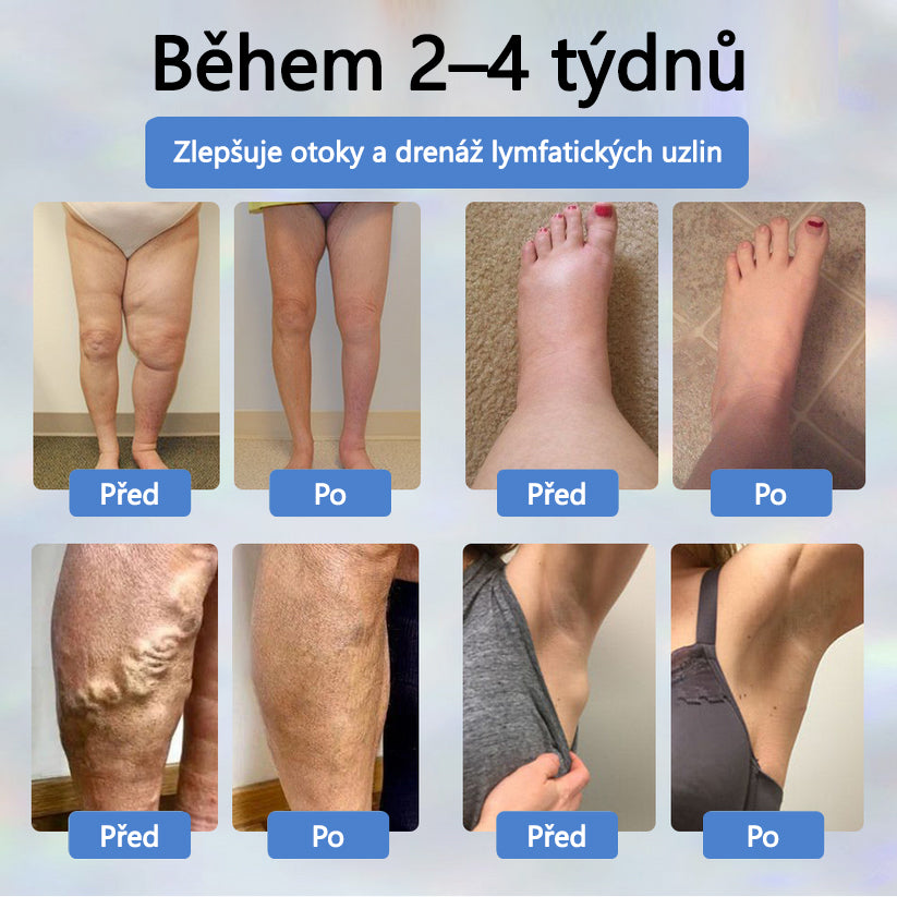 Cvreoz® Černý kmín Edema Detoxikační bylinný krém✨