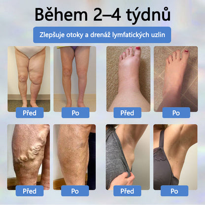 Cvreoz® Černý kmín Edema Detoxikační bylinný krém✨