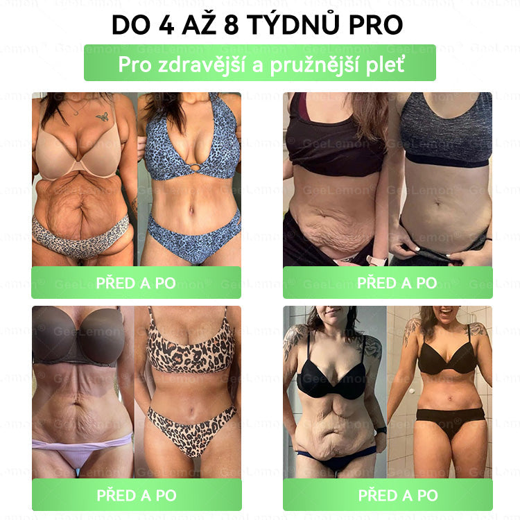 🔥Doporučeno Fakultní nemocnicí Motol · 👩‍⚕️ Oficiální prodejna BENU | 🎁 𝐆𝐞𝑒𝑙𝑒𝐦𝐨𝐧® Glum𝐚𝐬𝐞tide 8 v 1 – Zeštíhlující nano mikrojihlový náplast 🇨🇿 Jen 1× denně ✅ Viditelné změny za 7 dní – na obezitu, kardiovaskulární zdraví, diabetes a kloubní problémy🎁🎁🎁🎁