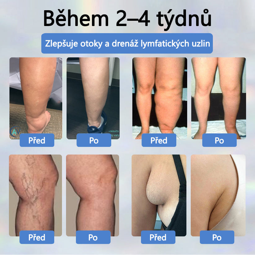 Cvreoz® Černý kmín Edema Detoxikační bylinný krém✨