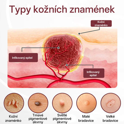 🔥Biancat®KeraErase Krém s dvojím účinkem pro obnovu vlasů🔥