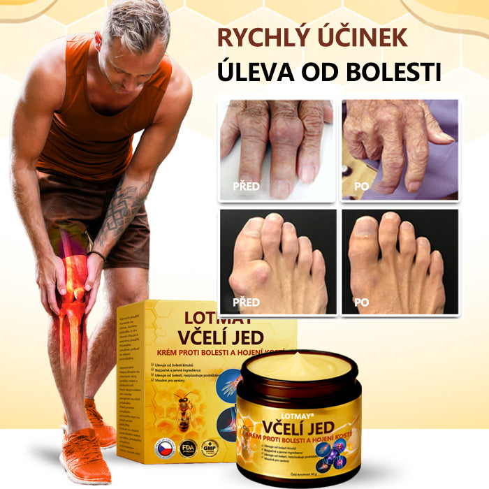 LOTMAY® Krém na hojení kostí proti bolesti se včelím jedem 🐝🐝