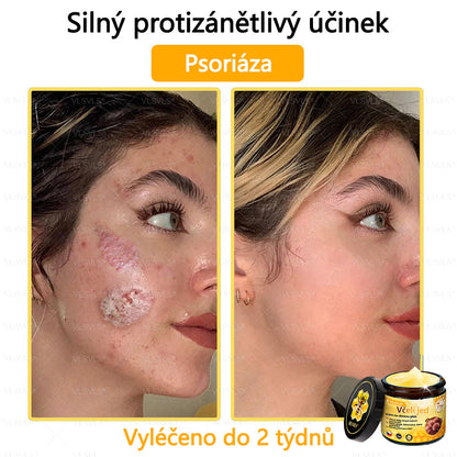 ✅VLSVLS™ Obnovující krém se včelím jedem🐝🐝