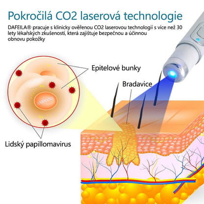 Laserové pero pro odstraňování znamének a bradavic DAFEILA® LumeSkin