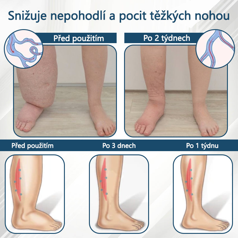 Cvreoz® Černý kmín Edema Detoxikační bylinný krém✨