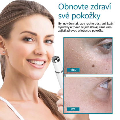 Laserové pero pro odstraňování znamének a bradavic DAFEILA® LumeSkin