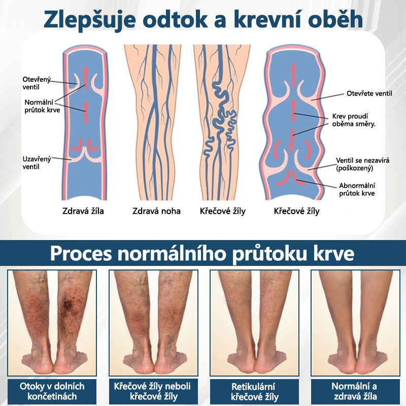 Cvreoz® Černý kmín Edema Detoxikační bylinný krém✨