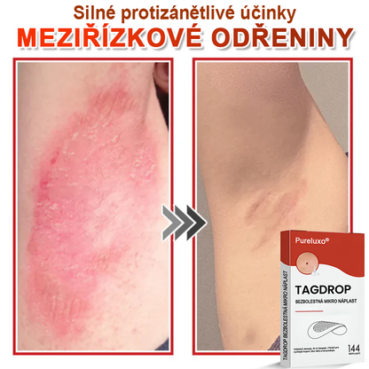 Pureluxo® Mikrovpichová botanická náplast na odstranění kožních výrůstků 🇨🇿 Vyrobeno v Česká republika🇨🇿🇨🇿🇨🇿🇨🇿