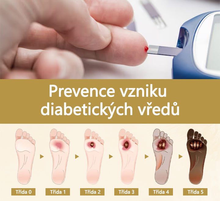 【Oficiální značkový obchod】Timilk® Sprej na hojení diabetické nohy - s obsahem včelího jedu🍃🍃
