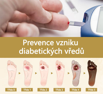 【Oficiální značkový obchod】Timilk® Sprej na hojení diabetické nohy - s obsahem včelího jedu🍃🍃