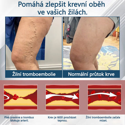 Cvreoz® Černý kmín Edema Detoxikační bylinný krém✨
