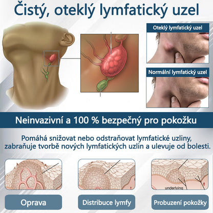 Cvreoz® Černý kmín Edema Detoxikační bylinný krém✨